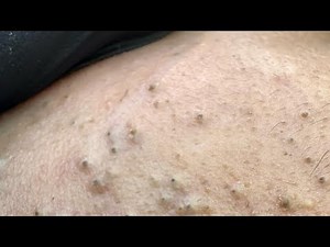 Radiant Skin, Easy Routine: My Daily Facial Cleansing Remedies