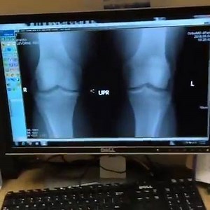 110K views · 3.1K reactions | Dr. Update on Levrone returning to the Mr.Olympia stage 2016 #levrozone | Kevin Levrone | Facebook