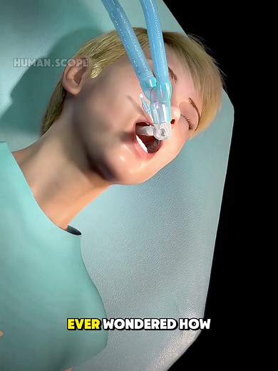 This is how endotracheal intubation is performed | medical animation #endotrachealintubation #intubation #airwaymanagement #lifesavingprocedure #USAmedical