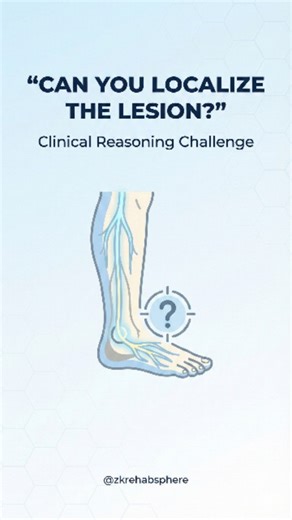 ZK Rehab Sphere on Instagram: "📍 Clinical Reasoning Challenge for Physios & Medical Students A 28-year-old male presents with: • Sudden foot drop • Cannot dorsiflex the ankle • Sensory loss on dorsum of foot • Knee reflex is normal 👉 Question: Where is the lesion? A) L4 nerve root B) L5 nerve root C) Common peroneal nerve D) Sciatic nerve 🧩 This is a classic neuro-localization question that tests your understanding of: • Myotomes • Dermatomes • Reflexes • Peripheral nerve