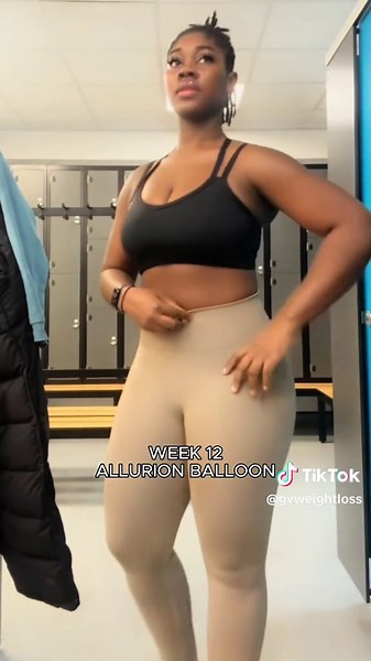 Gastric Balloon Weight Loss: Transform Your Health Journey