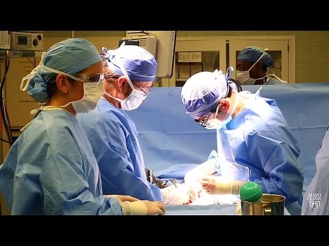 Mayo Clinic Minute: Living donor organ transplants