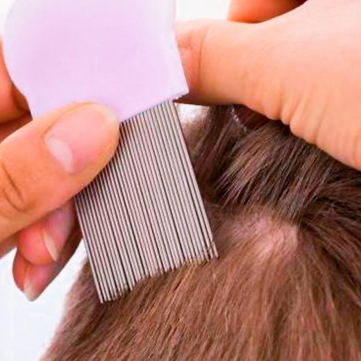 41K views · 997 reactions | Meilleure recette pour se débarrasser des POUX et des LENTES ! Rapide et pratique | Prenez Cette Recette | Facebook