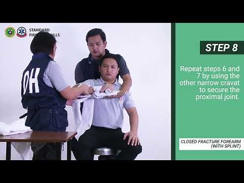 CLOSED FRACTURE FOREARM WITH SPLINT