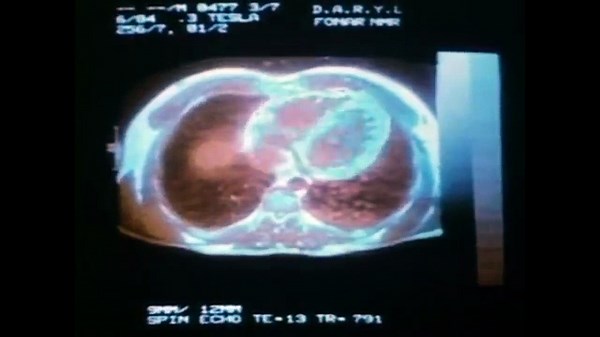 D.A.R.Y.L. (1985) - Bande annonce