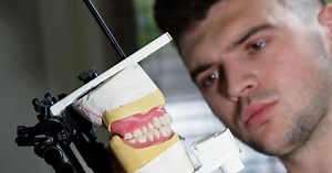 Getting dentures: discover the process from start to finish