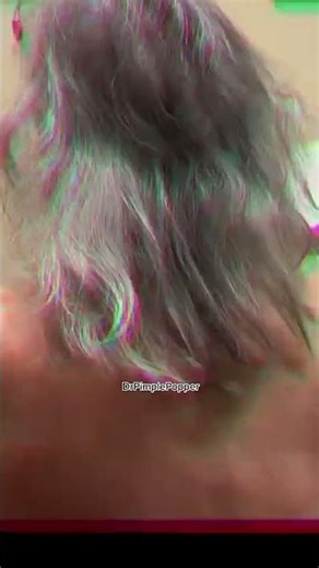 Obsessed not Abcessed