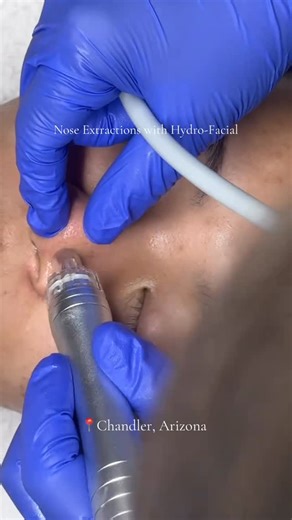 Ashley • Gilbert Esthetician | Custom Facials | I love the @zemits.official Hydro Diamond Machine ❤️ For your Custom Hydro Valentines Experience Limited Spots available for February link... | Instagram