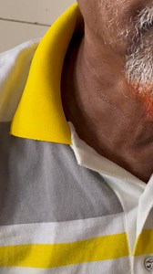 This is called "Dancing Carotid".এটা commonly পাওয়া যায় Aortic Regurgitation এ। | Dr. Sawgat Ehsan