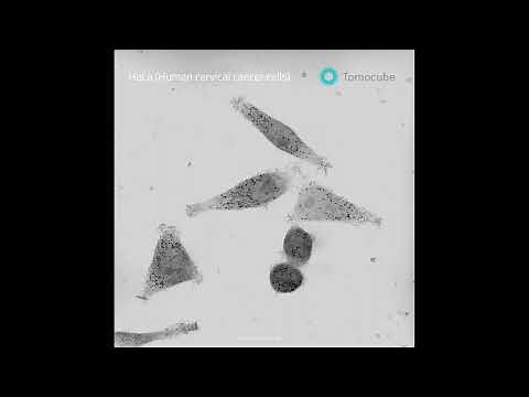 Mitosis and human cervical cancer cells​ (HeLa)