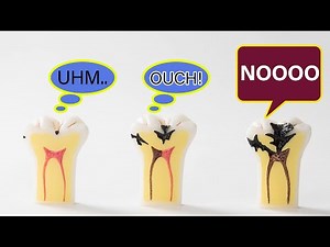 Tooth pain? It's telling you the important signal