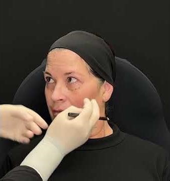 Marking for MD Codes - CK1 anchor