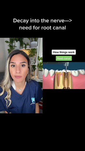 Dentistry: Root Canal Procedure Explained