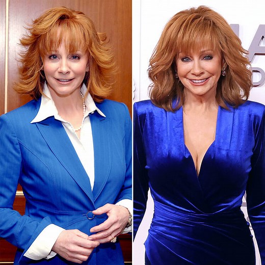 Has Reba McEntire Had Plastic Surgery in the Past? See the Country Superstar’s Transformation Photos