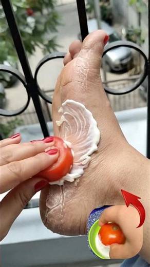 The strongest homemade recipe to deeply moisturize dry feet and heal cracked heels fast! 🦶