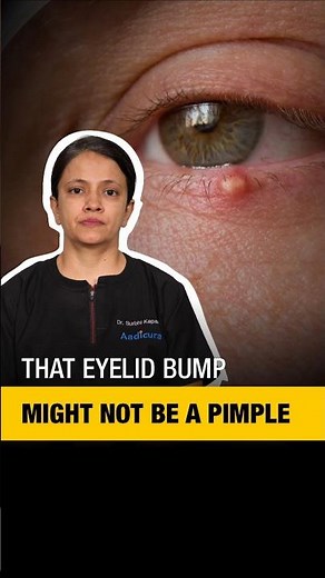 What Causes EYELID BUMPS and How to Get Rid of Them
