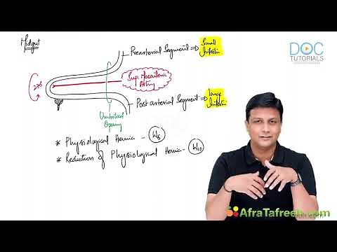 Gut Embryology Part 2 | Midgut Rotation & Herniation Explained by Dr. Azam | MBBS Must-Know