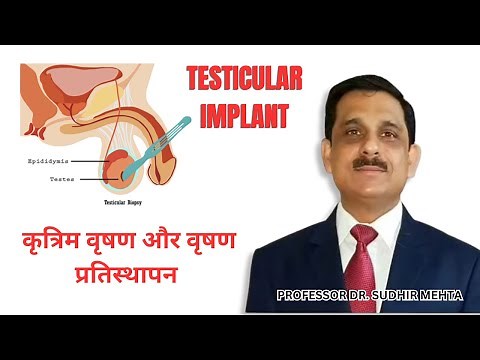 Testicular Implant Surgery: Artificial Testis & Testis Replacement Explained! #TESTICULAR