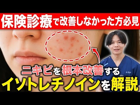 【繰り返すニキビに】保険診療で改善しなかった方にオススメのニキビ治療！イソトレチノインを解説！#ニキビ #ニキビ跡