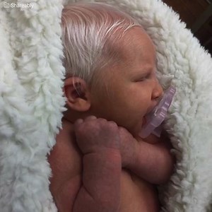 580K views · 1.9K reactions | Before she was even able to hold her newborn daughter in her arms, the doctors took her from Jessica and rushed her somewhere else. The unusual aspect of the baby raised the alarms; the doctors had to run some tests. The mother never thought she would conceive a baby who looked like an old person, but it was all because of a rare genetic combination. | Upbeat | Facebook