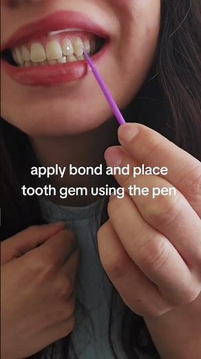 Temporary Tooth Gem Kit Instructions