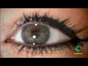 Laser eye color change before and after