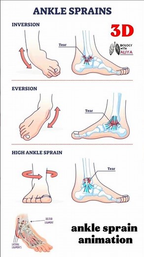 ankle sprain animation #medical #animation #3d #short | Biology with Aliya