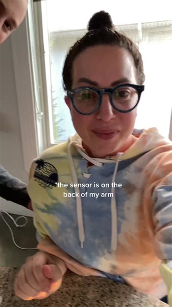 Continuous Glucose Monitoring with Dexcom: Best Sensor Placement Options