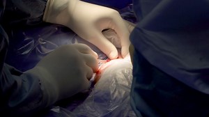 Process Of Cutting Skin With Scalpel In Stock Footage SBV-325621070 - Storyblocks