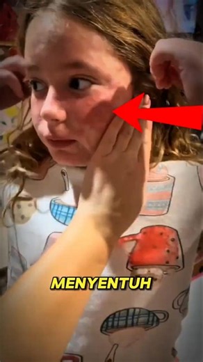 She Didn't Expect This Was What Touched Her Child's Skin 😱 #shorts #creepy #viralvideo