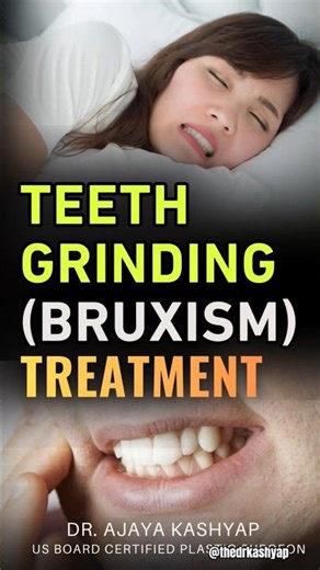 Teeth Grinding (Bruxism) Treatment | Expert Insights & Solutions