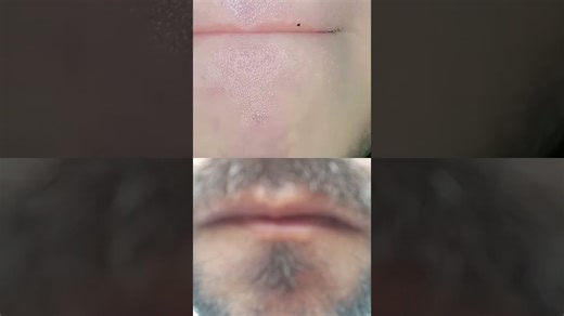 Trollface Memes is back 😂🔥 | TrollFace Edit #trollface #edit #troll #memes #funny #memeedit