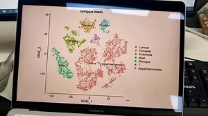 虽然恶心但能三天学会单细胞转录组分析，全部代码均有详细中文注释，已经排除bug，可直接复制粘贴运行。