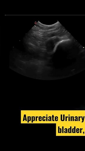 Urinary bladder - Ultrasonography of dog