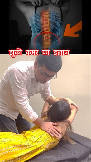 Kyphosis Back Pain Problem | Chiropractic Treatment