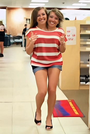 6.1K views · 20 reactions | “One body. One wedding. One husband?!”  The most famous conjoined twins just got married — and the wedding photo has everyone losing it. You have to see the footage in the comments below  | Know It All: About Everything | Facebook