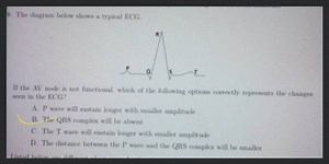 The diagram below shows a typical ECG. If the AV node is not fu... | Filo