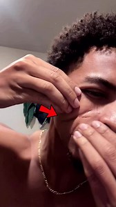 Scar Trick That Will Fool You!