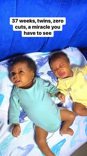 78K views · 13K reactions | 37 weeks. Twins. No episiotomy. The doctors couldn’t believe it. Two babies, one mama, a miracle that still shocks everyone. While others were cut and crying… I walked out with two babies and zero tears. #TwinMom #MotherhoodJourney #MiracleBirth #StrongMama #RealMotherhood | Vikkysuperb Couple | Facebook