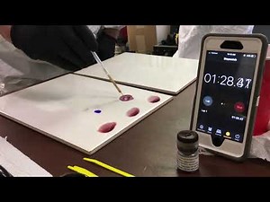 How to Conduct the Rapid Whole Blood Test