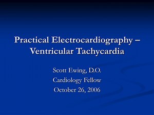 Comprehensive Guide to Ventricular Tachycardia Diagnosis - SlideServe