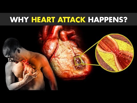 Why Heart Attack Happens? | Causes Of Heart Attack!