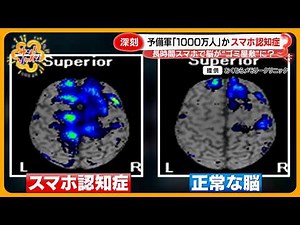 【深刻】予備軍1000万人？｢スマホ認知症｣とは…長時間利用で脳が“ゴミ屋敷”に【サン！シャインニュース】
