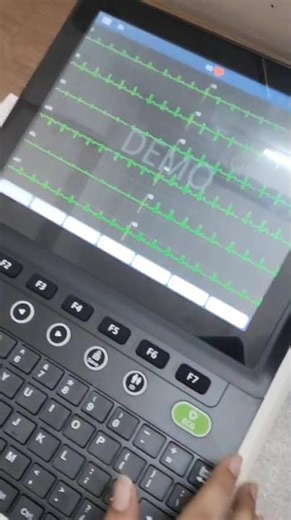 ECG Machine Paper Installation Guide