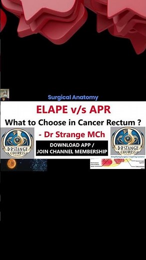 #shorts #5 - Extra Levator Abdominoperineal Excision (ELAPE) Vs APR. #ELAPE #cancerrectum