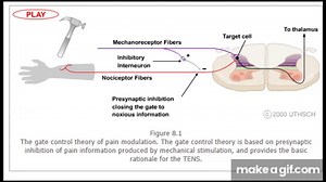 Gate Control.mp4 on Make a GIF