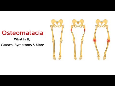 What is osteomalacia?