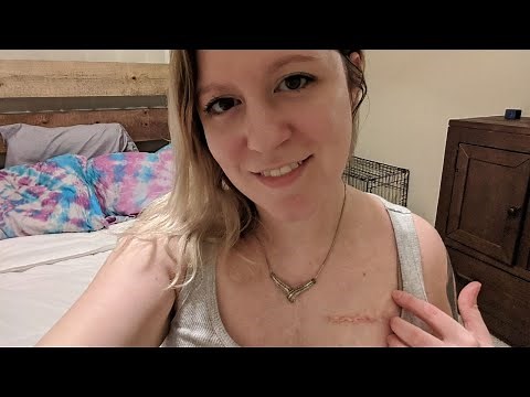 I just had my pacemaker replacement surgery