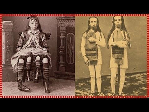 Rare Photos Of The Circus From The Past (part#2)