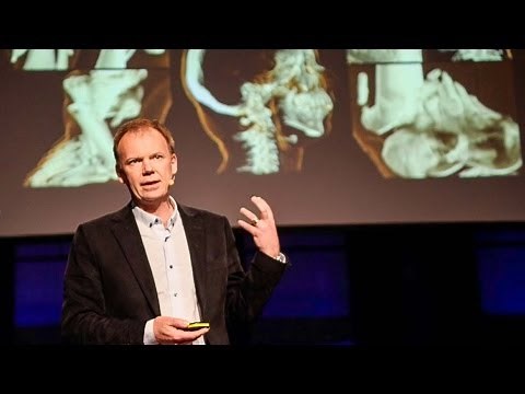 Visualizing the medical data explosion - Anders Ynnerman